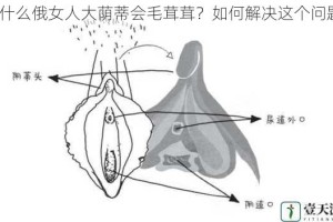 为什么俄女人大荫蒂会毛茸茸？如何解决这个问题？