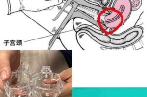 鸭嘴钳撑开检查调教 H 时，如何避免疼痛？