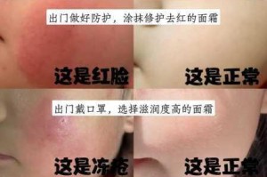 嫰BBB 槡BBBB 槡BBBB的皮肤问题怎么解决？