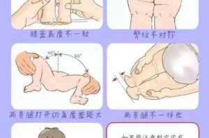 宝宝腿开大点一会就不疼了漫画：为什么会这样？如何缓解？