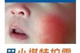 麻酥酥哟，为什么我的脸总是红彤彤的？如何才能告别高原红？