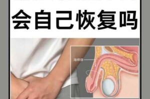男 m 必做羞耻任务，为何-怎样做才能既满足对方又保护自己？