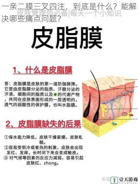 一亲二膜三叉四注,到底是什么?能解决哪些痛点问题?