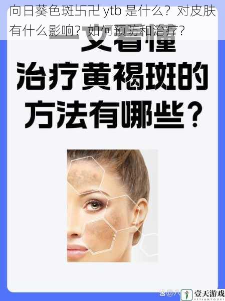 向日葵色斑卐卍 ytb 是什么?对皮肤有什么影响?如何预防和治疗?
