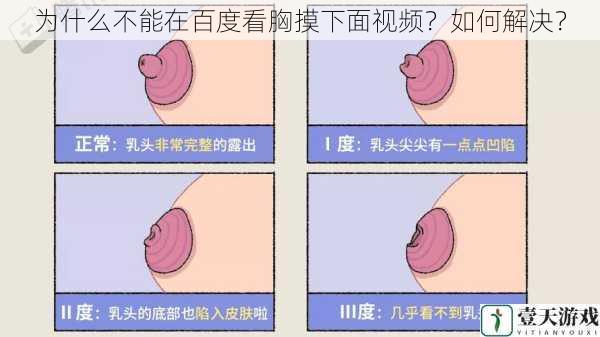 为什么不能在百度看胸摸下面视频?如何解决?